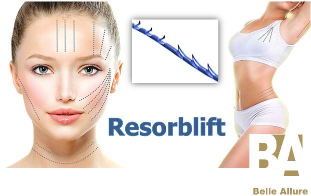 Продвинутый курс нитевого лифтинга Resorblift височной области с индивидуальной постановкой руки!!