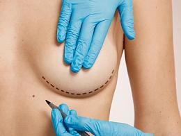 Подятжка груди нитями