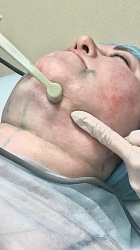 Советы косметолога: как женщинам и мужчинам быстро убрать второй подбородок